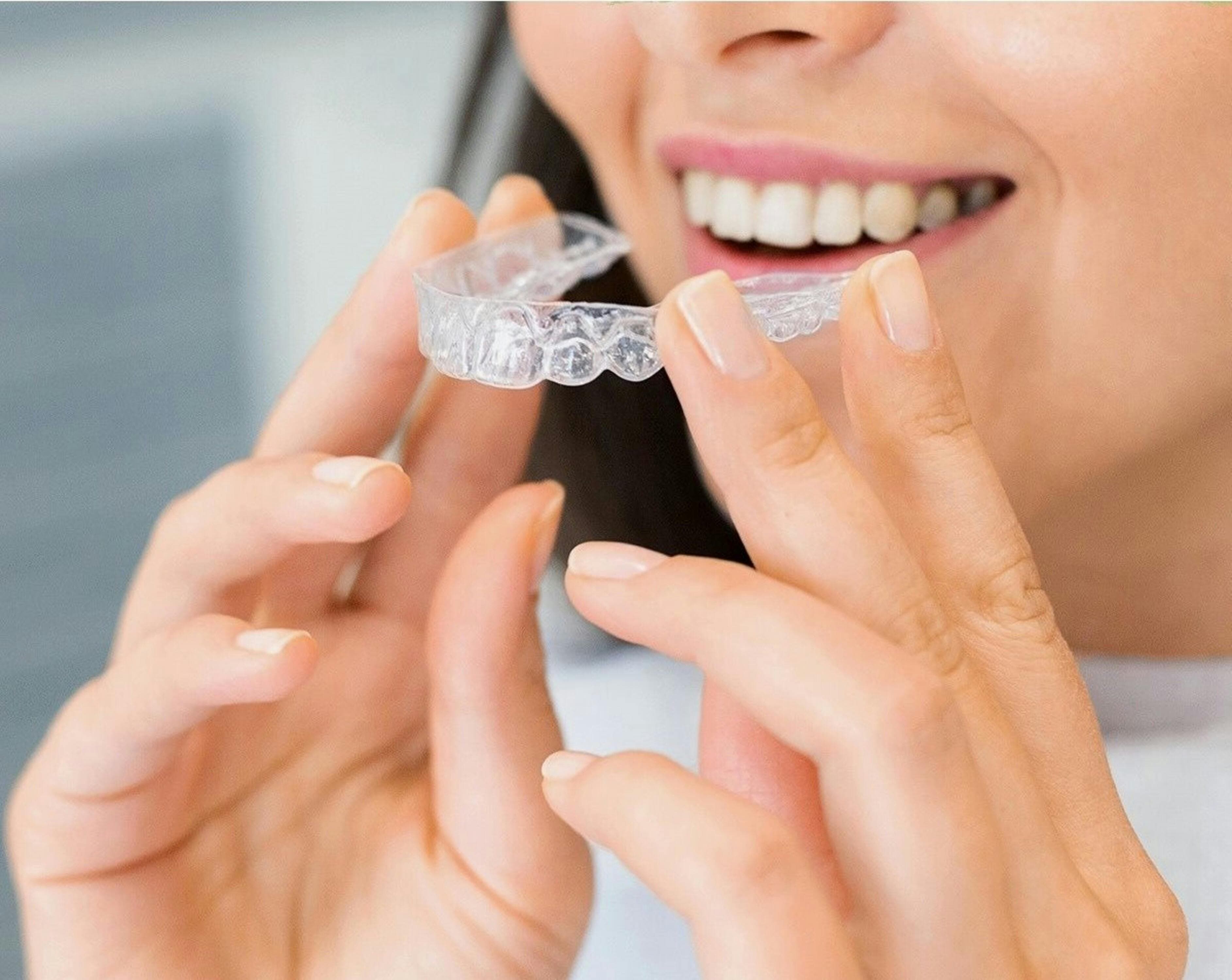 Aligneurs transparents
